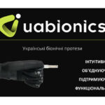 Компанія «ALLBIONICS» пропонує безоплатне протезування